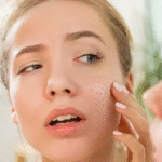 Termal ve Sıcak İklimde Ciltte Dengeyi Koruma